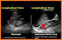 Fast Scan related image