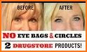 Get Rid of Bags Under Eyes related image