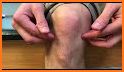 Knee pain related image