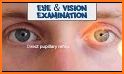 Optometry & Ophthalmology eye measure and eye-exam related image