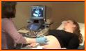 Ultrasound for pregnancy related image