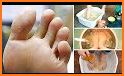 Home Remedies for Foot Odor related image