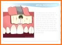 Microsurgical Endodontics related image