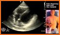 Fast Scan related image