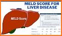 MELD Score Calculator - Liver Disease App related image
