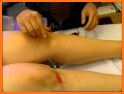 Best Time Acupuncture related image