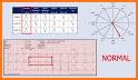 Electrocardiogram (ECG) Rhythm App: Heart Axis related image