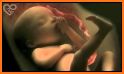 Prenatal Ultrasound Lite related image
