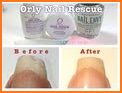 Nail Rescue related image