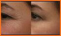 How to Reduce Wrinkles: The Natural Way related image