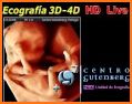 MyGuttenberg related image