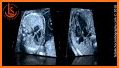 Prenatal Detection of CHD 2018 related image