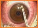 Eye Transplant Surgery Hospital Doctor related image