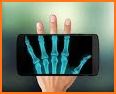 XRay Scanner Prank related image