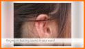 Whist - Tinnitus Relief related image