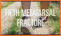 Practical Fracture Treatment 5 related image