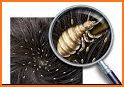 How to Get Rid of Lice related image