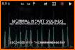 Heart Sound Stethoscope related image