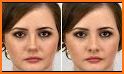 Nose Job Photo Editor related image