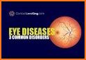 All Eye Disorders related image