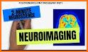 Neuro Imaging related image