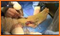Nail & Foot doctor - Knee replacement surgery related image