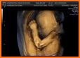 Baby Scan 3D related image