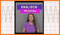 ECG FlashCards 2 - Reference App Most common EKGs related image