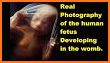 Fetus Camera related image