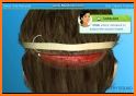 Hair Transplant Surgery : Doctor Simulator Game related image