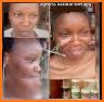 Our Melanin related image