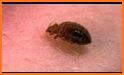 Bedbugs Disease related image