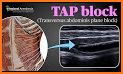 Tetra Tap: Block Buster related image