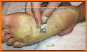Foot Surgery Doctor Salon related image