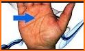 Palmistry - reading fate related image