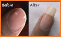 How to Grow Nails Fast related image