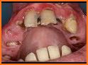 Crazy Dentist - Teeth Bling related image