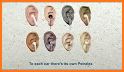 Petralex Hearing aid related image