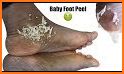 Baby Feet related image