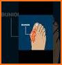 Orthopedic Anatomy related image