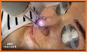 Laser Therapy Tips related image