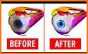Eye Doctor Trainer - Exercises to Improve eyesight related image