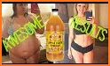 APPLE CIDER VINEGAR DIET - Lose Weight Easily related image