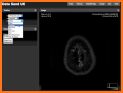 Dicom Medical Image Viewer related image