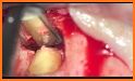 Microsurgical Endodontics related image