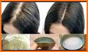 Natural home remedies for hair fall related image