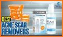 Acne Scar Removal Tips and Tricks related image