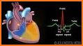 EKG-card™ related image