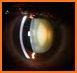Easy Ophthalmology Atlas related image