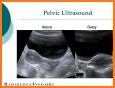 Ultrasound in Obstetrics and gynecology related image